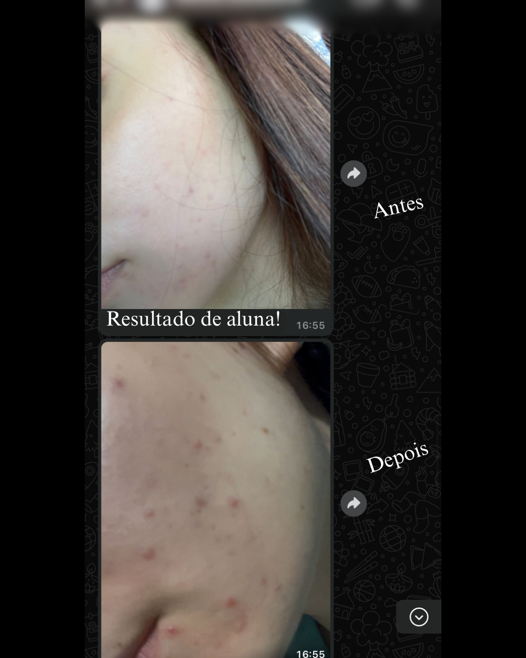 Antes e depois de aluna